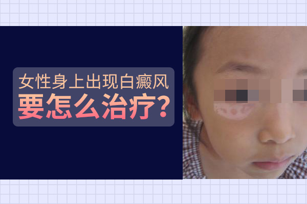 女孩子臉上長塊白癜風要怎么處理呢？
