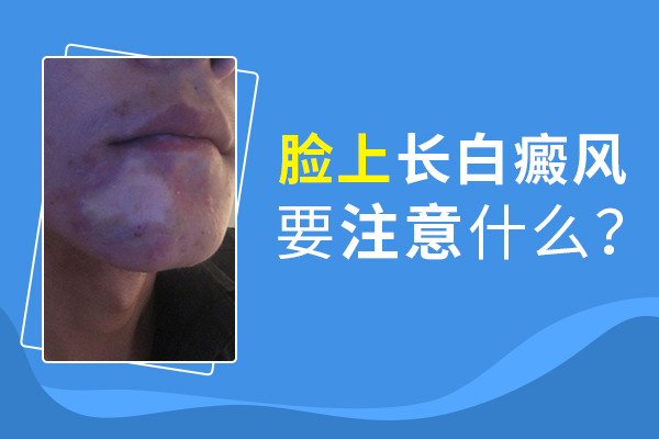 臉部白癜風患者應該怎么護理呢？