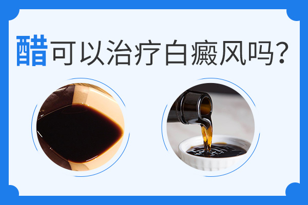 喝醋真的能夠治療白癜風嗎？